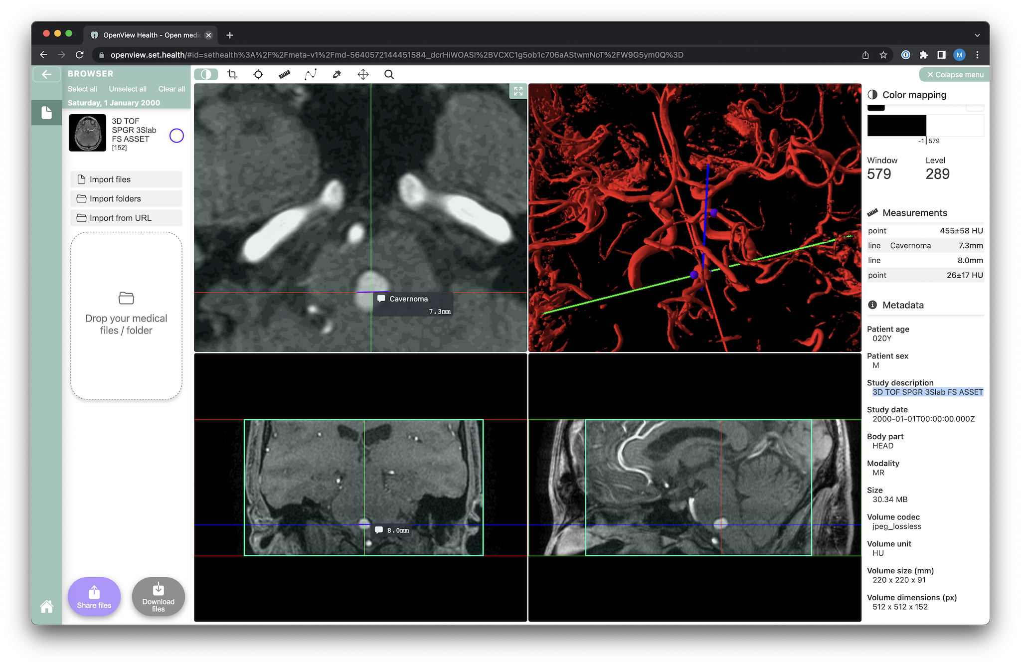 Screenshot of Open View health