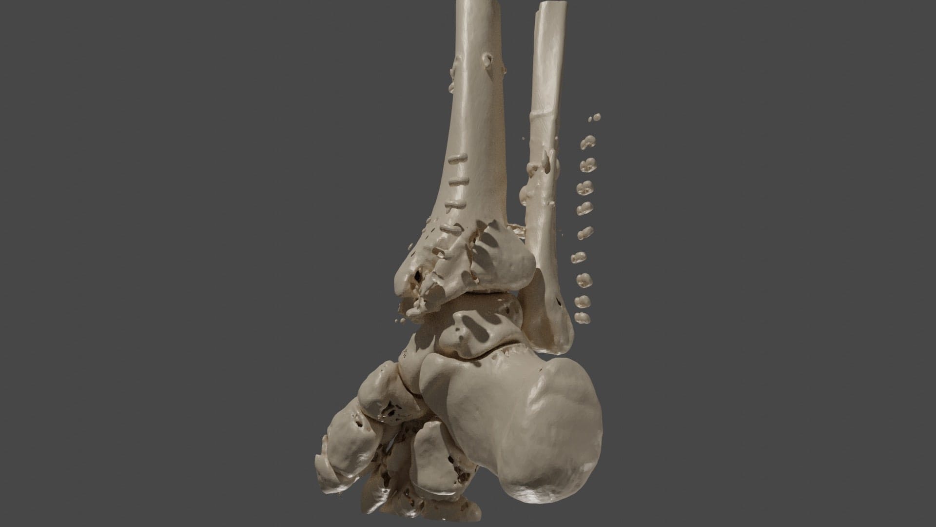 Ray tracing of my ankle using set.health tech
