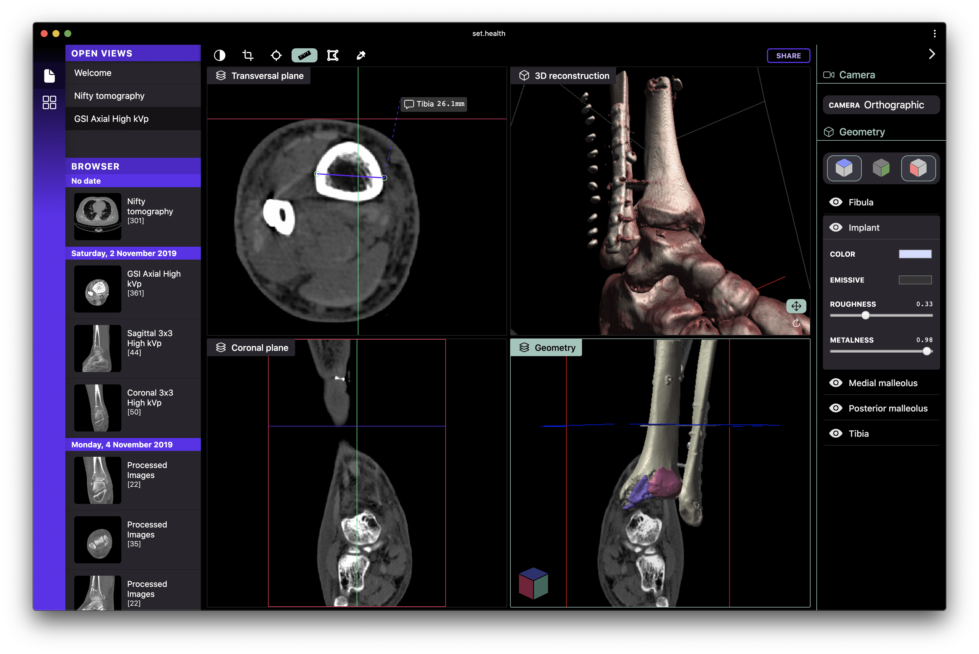 Tech demo showcasing my very own ankle